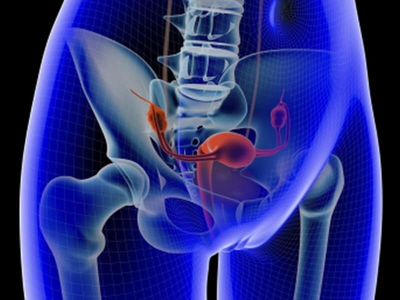 Brachy Therapy Johannesburg